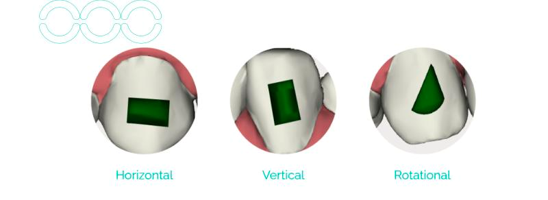 attachment-types